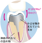 リスク2