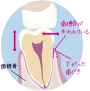 リスク4